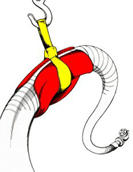 large bore hosebun large bore hosebun